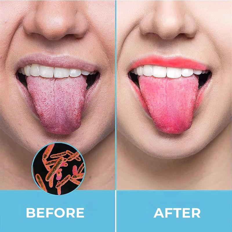 HOKIN Stainless Steel Tongue Cleaners - Pack of 2 Oral Care Scraper for Men and Women, Reduce Bad Breath and Hygiene Aluminum Engine Bearing Press